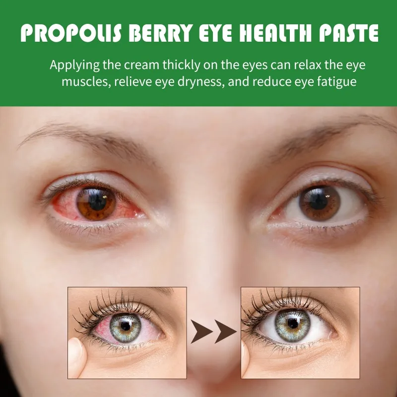 Eye Cream Propolis Berry Eye Balm Eye Bag Removal Anti Puffiness Reduces Dark Circles Anti-Wrinkle Whitening Skin Care Ointment