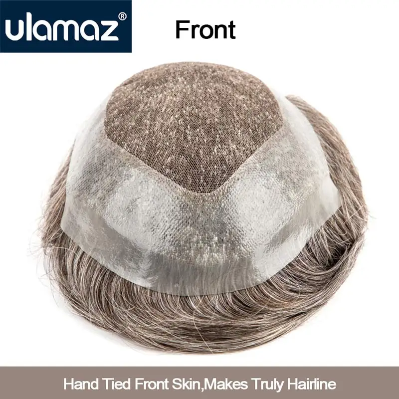 Рисунок 4 - Парик 6*8/7*9, швейцарский протез