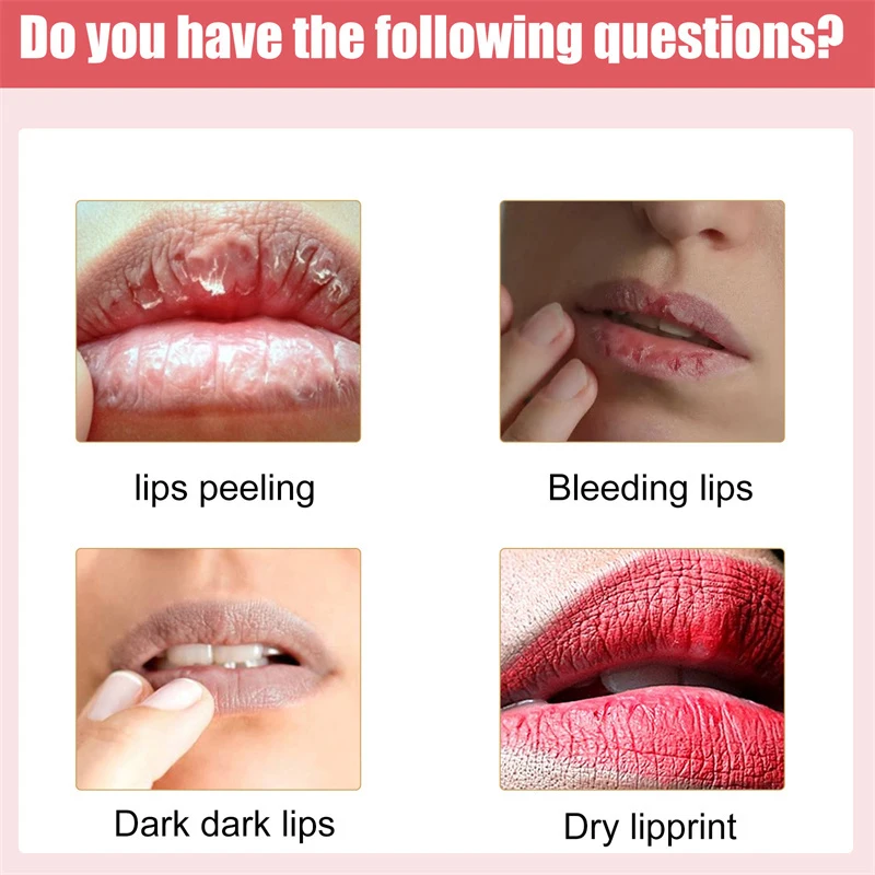 Lips Cream Fresh Pink Bleaching Treatment Remove Dark Smoke Lips Lip Balm Whitening Moisturizer Nourish Essence Dilute Melanin 4