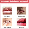 Lips Cream Fresh Pink Bleaching Treatment Remove Dark Smoke Lips Lip Balm Whitening Moisturizer Nourish Essence Dilute Melanin 4