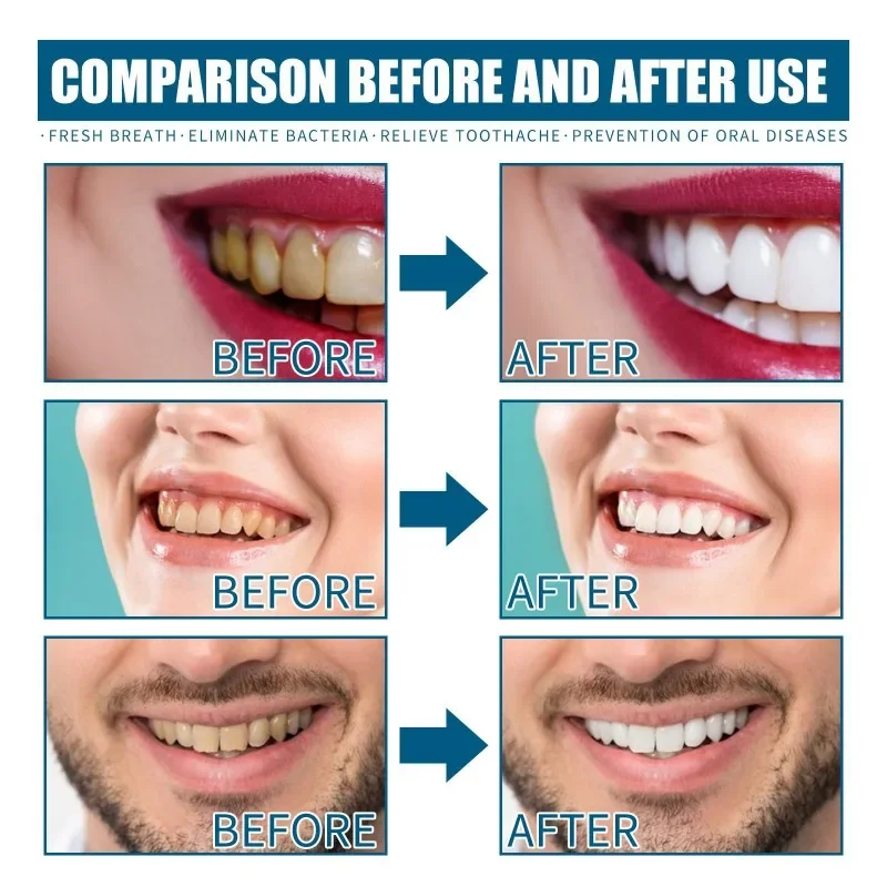 Teeth Whitening Product Teeth Whitening Essence Teeth Health Product Mouth Freshener Spray Mouthwash remove tooth stains odor clean Yellow tartar Whitening teeth Lasting fresh breath Mouth Toothpaste Oral Smell Care