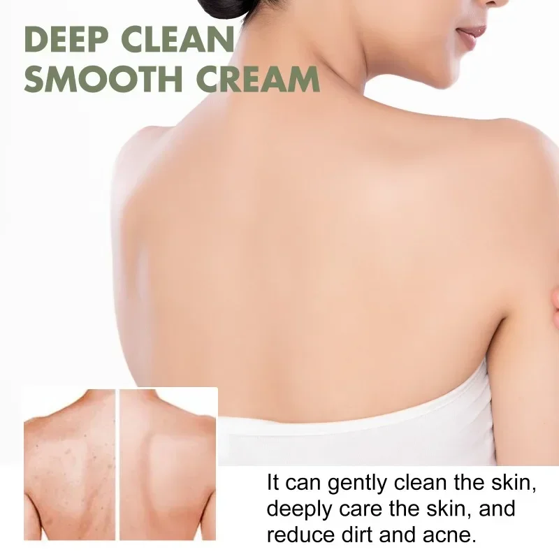 

Sdottor New Deep clean smooth cream moisturizing improve Dark spots exfoliation controls oil remove acne whitening body skin rep