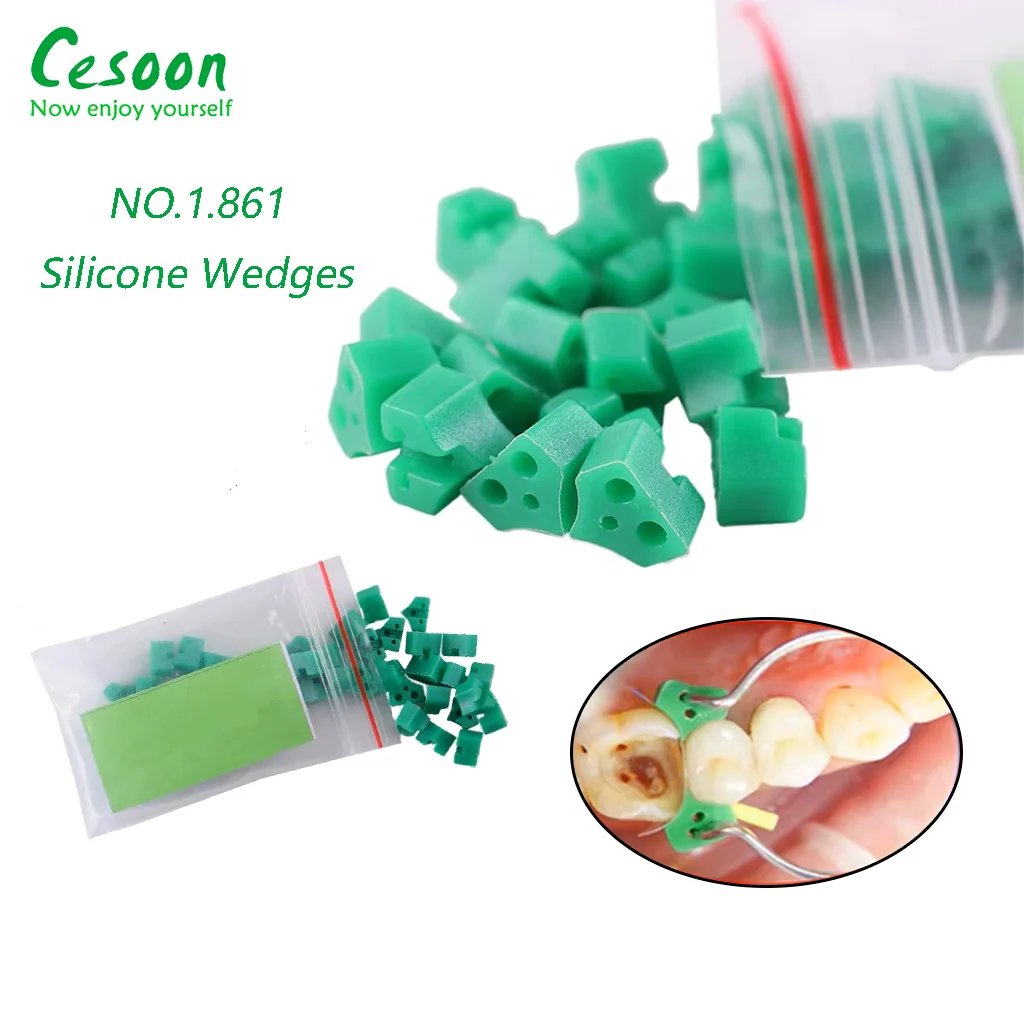 100-Piece Dental Matrix Kit With Wedges & Rings - Complete Set For ...