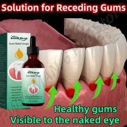 Gum Repair Drops Serum Relieve Receding Gum Remove Stain Gingival Swelling Care Whiten Toothpaste Periodontal Care Oral Hygiene