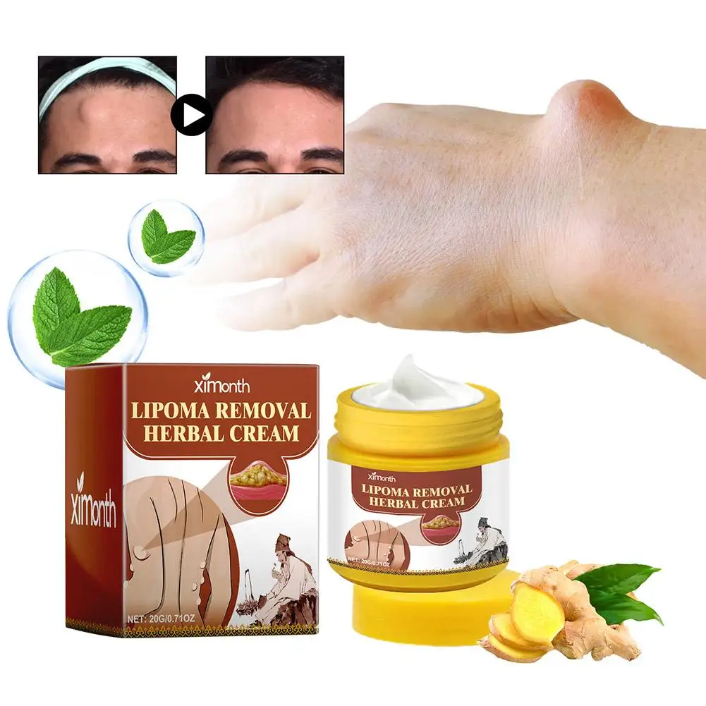 1pc Lipoma Removal Herbal Cream Body Cream Dissolving Fat Easy To Use Herbal Lipoma Removal Cream - Image 5
