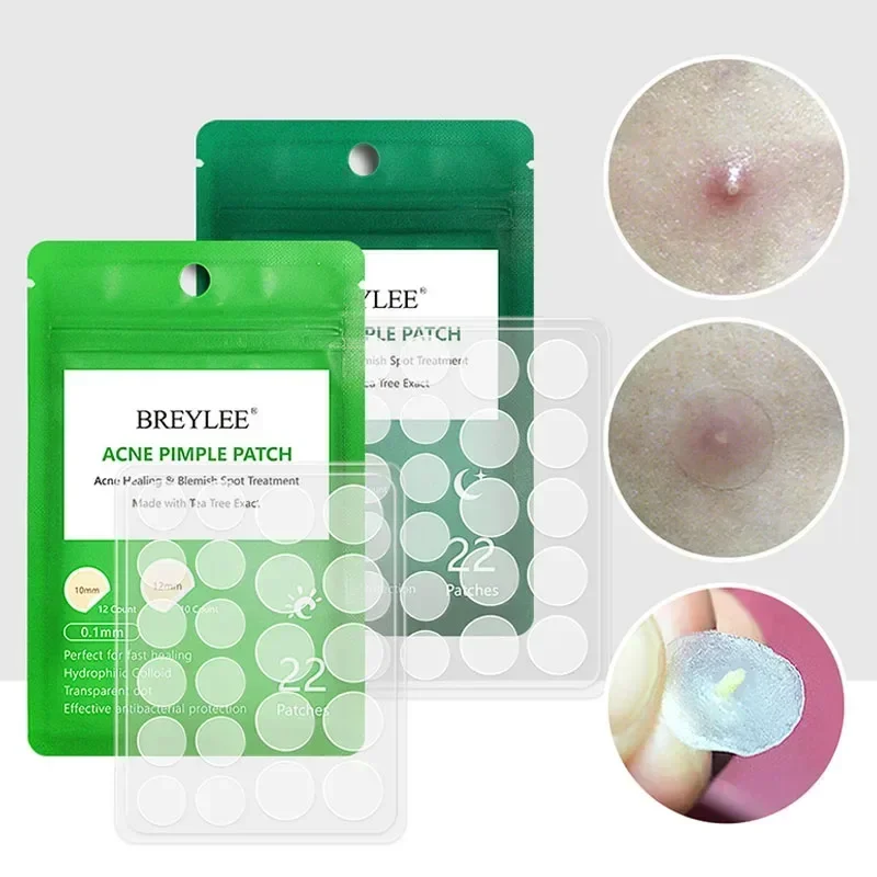 Natural Tea Tree Acne Stickers Water Proof Soothing The Skin 22 Pieces Facial Tools Acne Patch Ultra-thin Design Skin Care