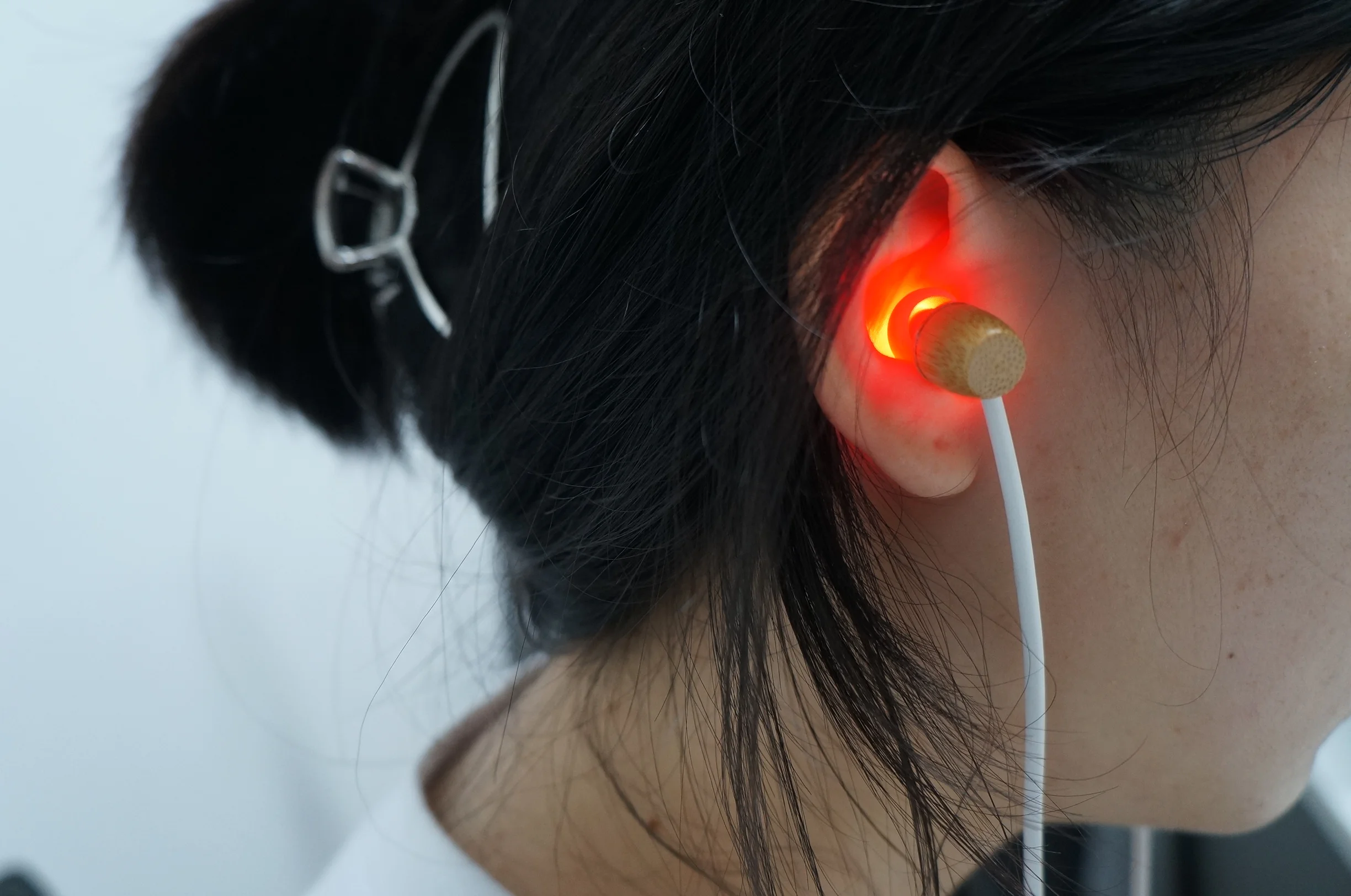 

Tinnitus Ear Laser Therapy LLLT Irradiation Laser Physiotherapy Earplug Otitis Media Deafness Nose Rhinitis Sinusitis Treatment