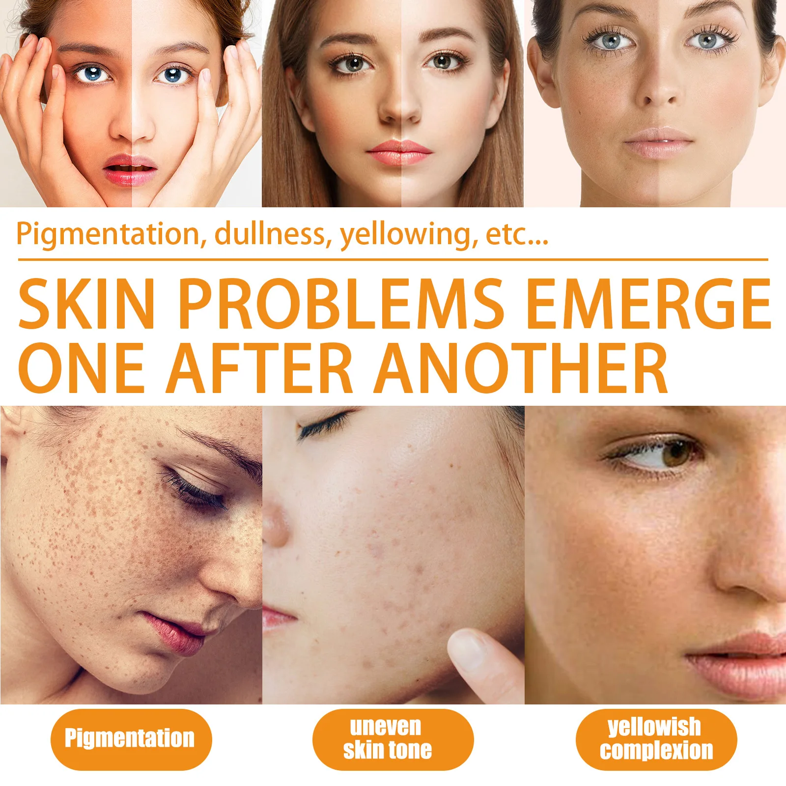 Vitamin C Whitening Freckle Face Serum Remove Melasma Dark Spot Fade Melanin Dull Moisturizing Brighten Smooth Skin Care Product