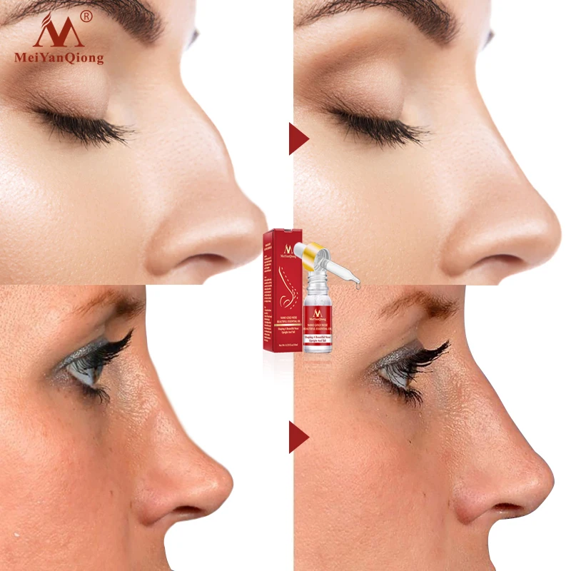 Nose Massage Essential Oil Nose Care Essential Oil Shape Beautiful Nose Remodeling Serum Lift Nose Care Thin Smaller Nose nose heighten serum rhinoplasty firming moisturizing nasal bone remodeling tighten shaping narrow thin smaller nose lift essence