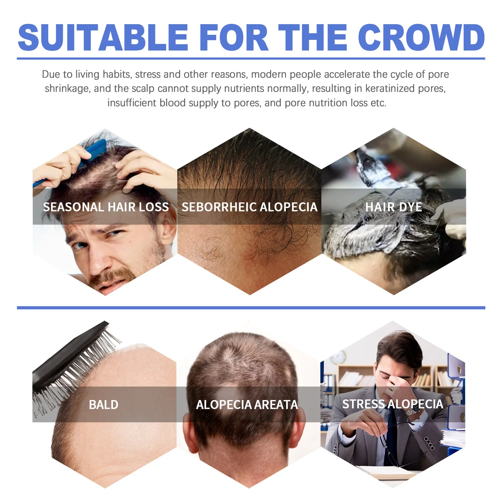 Hair Growth Foam Thinning Scalp Treatment Hereditary Seborrheic Hair Loss Regrowth Thicken Repairing Follicles Care Product