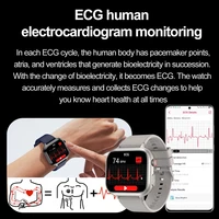 2026 New Health Analytics Smart Watch Uric Acid Blood Lipids Body Fat Monitoring ECG+PPG Bluetooth Call Smartwatch Men Women - Image 3
