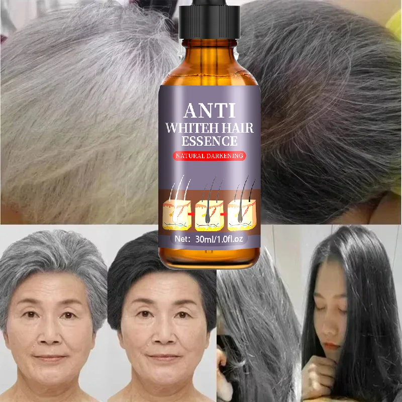 Siero Naturale Anti-Grigio per Capelli | Remedio Nutriente per la Cura dei Capelli - Ripara i Capelli Bianchi e Oscuranti - immagine 4