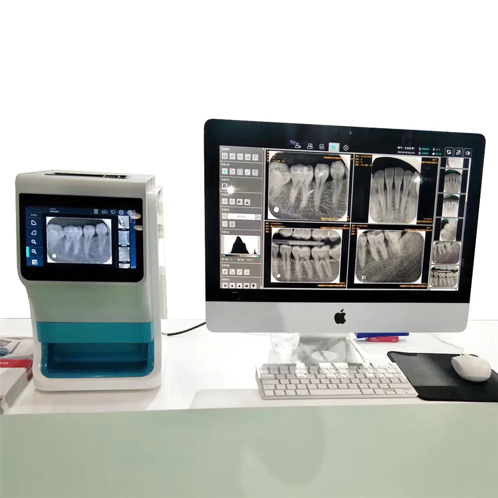 Рисунок 5 - Портативный сканер для стоматологической