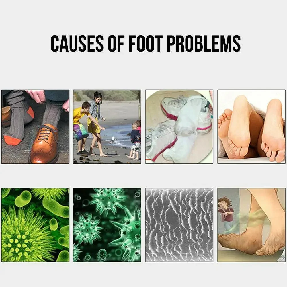 Description Picture 5 of itemSocks Shoes Deodorant Spray Shoes Stink Freshener Socks Odor Remover Spray Refresh Antiperspirant Foot Sweat Odor Remover 100ML