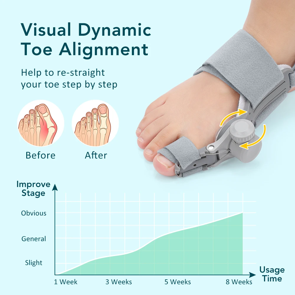 Adjustable Bunion Corrector Big Toe Hallux Valgus Valgus Corrector Rotatable Toe Straightener Toe Correction Foot Care Device