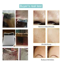 Skin Scrubber Blackhead Remover Cleanser
