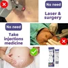Swelling Marks Remove Skin Cracks Body Creams 6