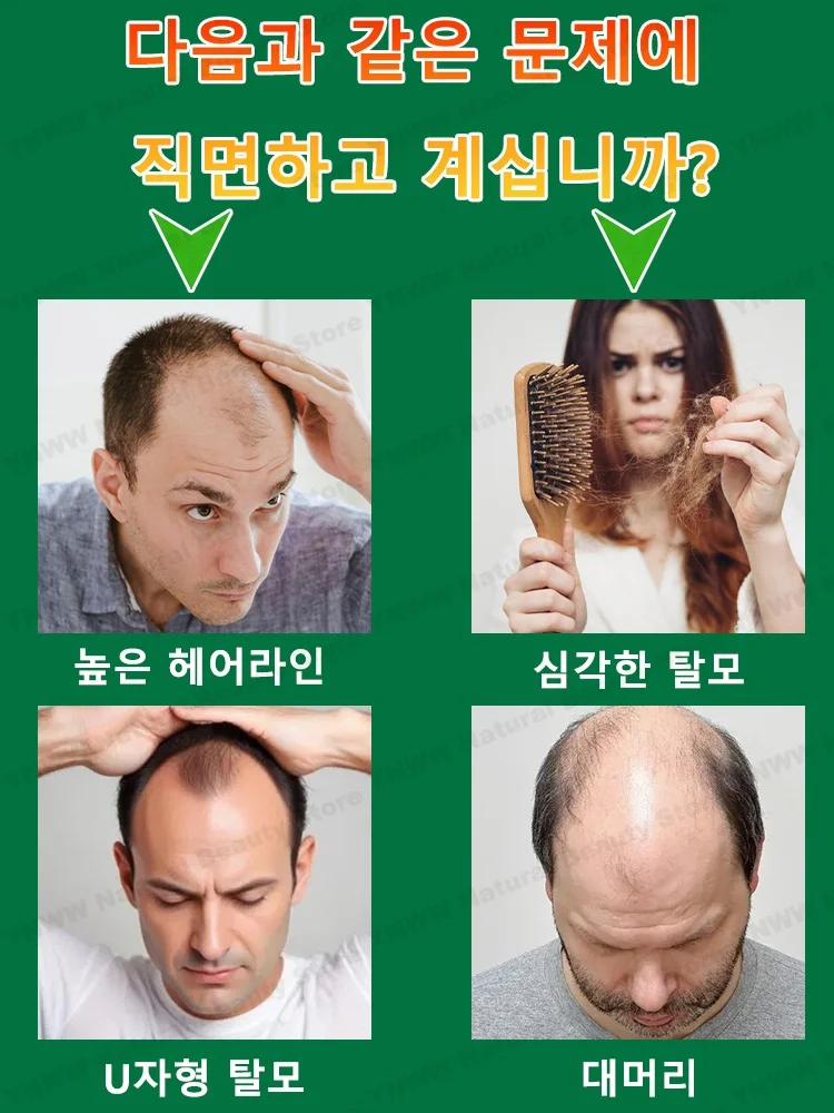 헤드 미니어 어플리케이터, 두피 어플리케이터, 모발 성장 솔루션, 볼 마사지 에센셜 오일, 빗 코팅