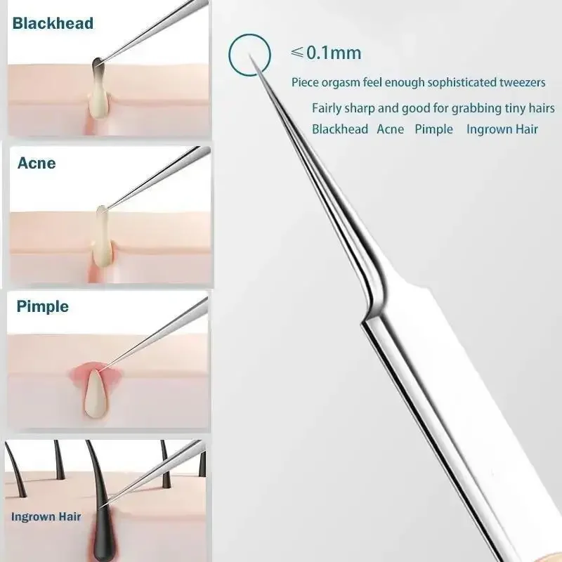 11Pcs Ingrown Hair Tweezers Acne Blackhead Removal Needles