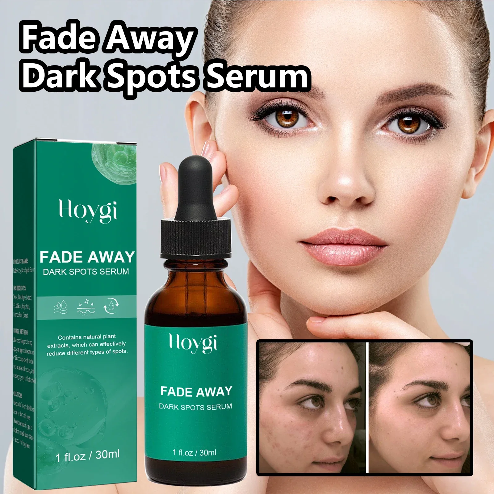 Dark Spot Remover Serum For Face Sun Melasma Freckles Pigment Age Spots Removal Freckle Whitening 2