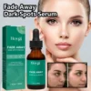 Dark Spot Remover Serum For Face Sun Melasma Freckles Pigment Age Spots Removal Freckle Whitening 2