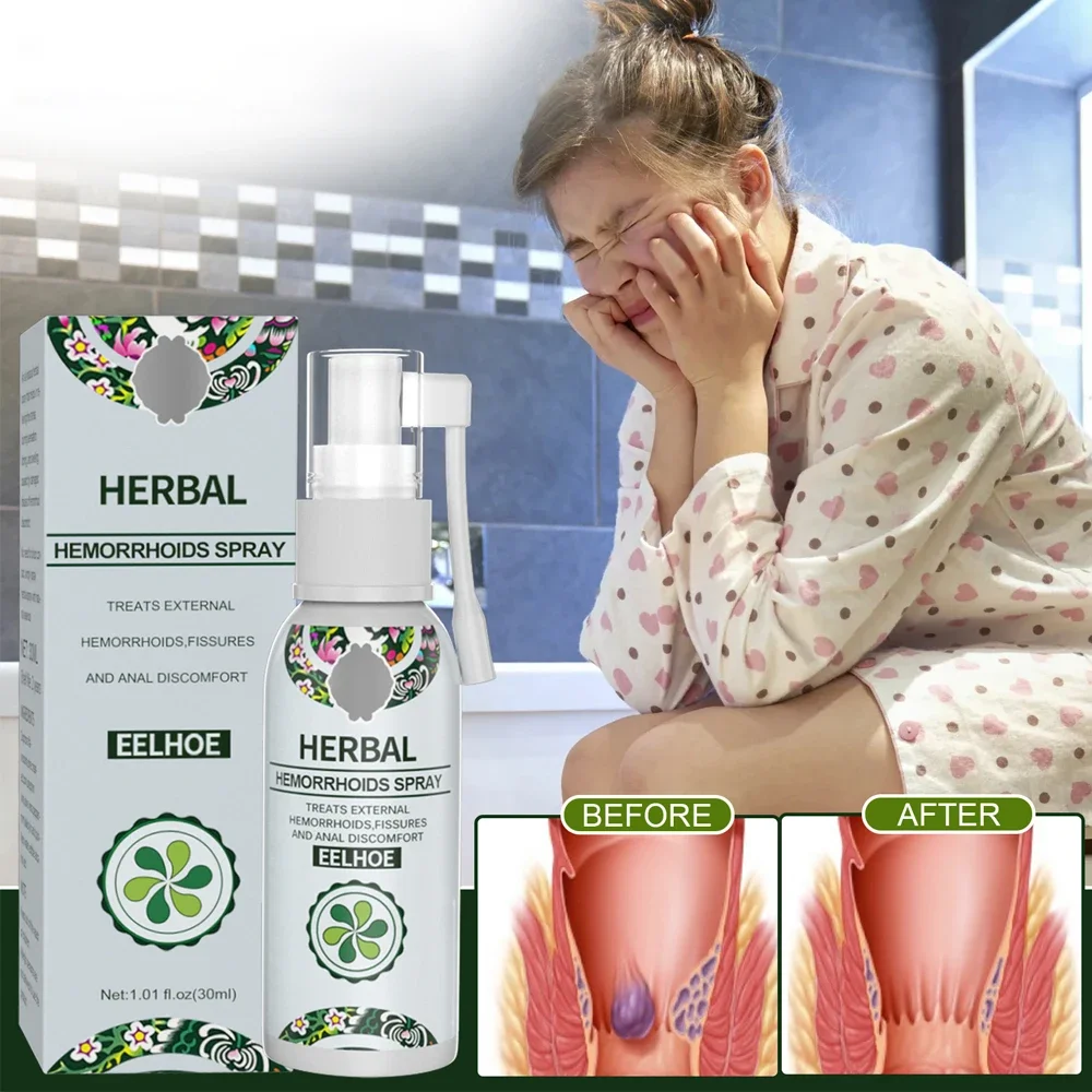 30ml Hemorrhoid Remover Spray Removal Internal Piles Natural Herbal Hemorrhoid Spray Soothing Pain