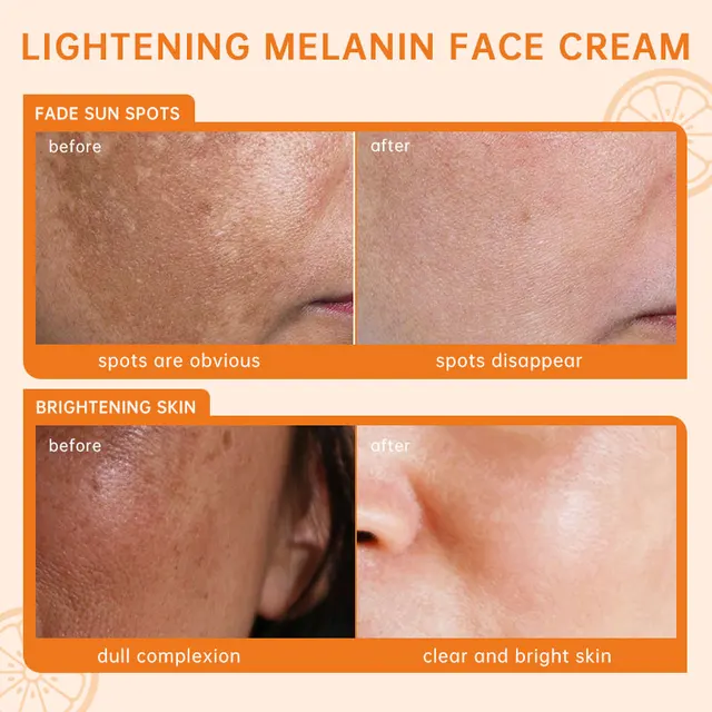 JoyPretty – ensemble de soins pour la peau, crème blanchissante, nettoyant, brillant, hydratant, pour la peau foncée, sérum, produits pour le visage, 5 pièces