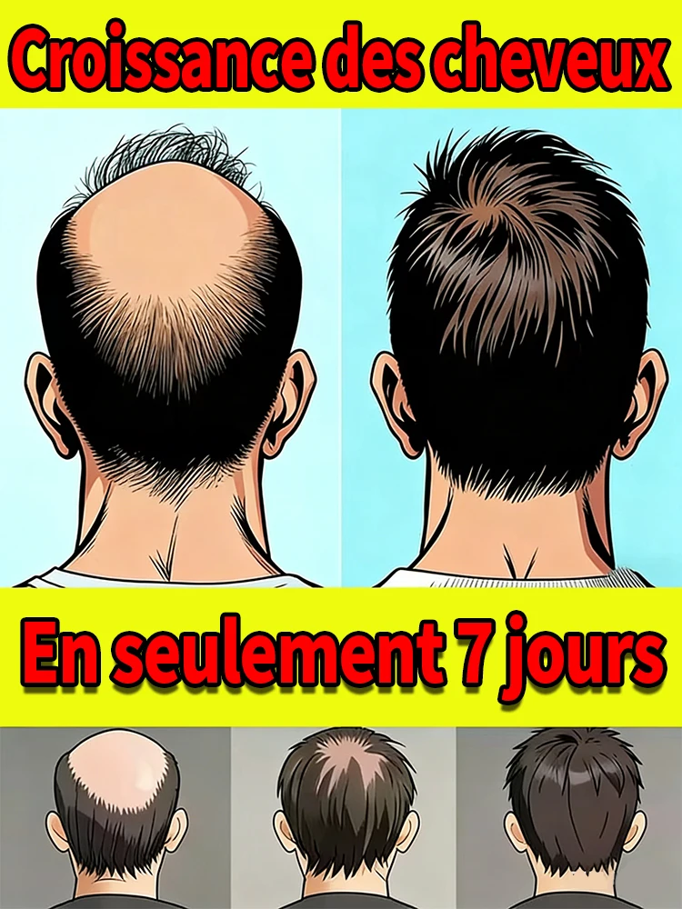 Generation-2,M-shaped,to Solve Hair Problems And Protect Your Scalp Health,care Tool_voghion.com