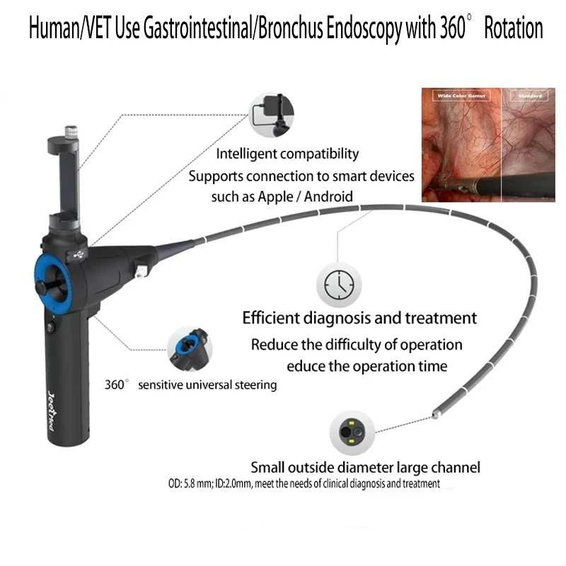 Video Laryngoscope Gastrointestinal Bronchus Endoscopy 360&deg; Rotation Support For IOS Android