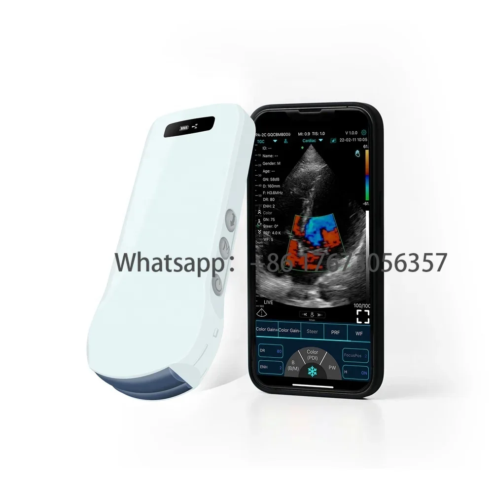 Portatile Doppler Ultrasuoni Ecografo Portatil Ecografo Sistema Color Doppler Laptop Ultrasound