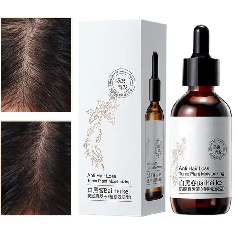 

60ml Hair Growth Oil Hair Strengthening Oil Anti Hair Loss Anti Breakage Thinning Hair Nourishing Oil For All Hair Types