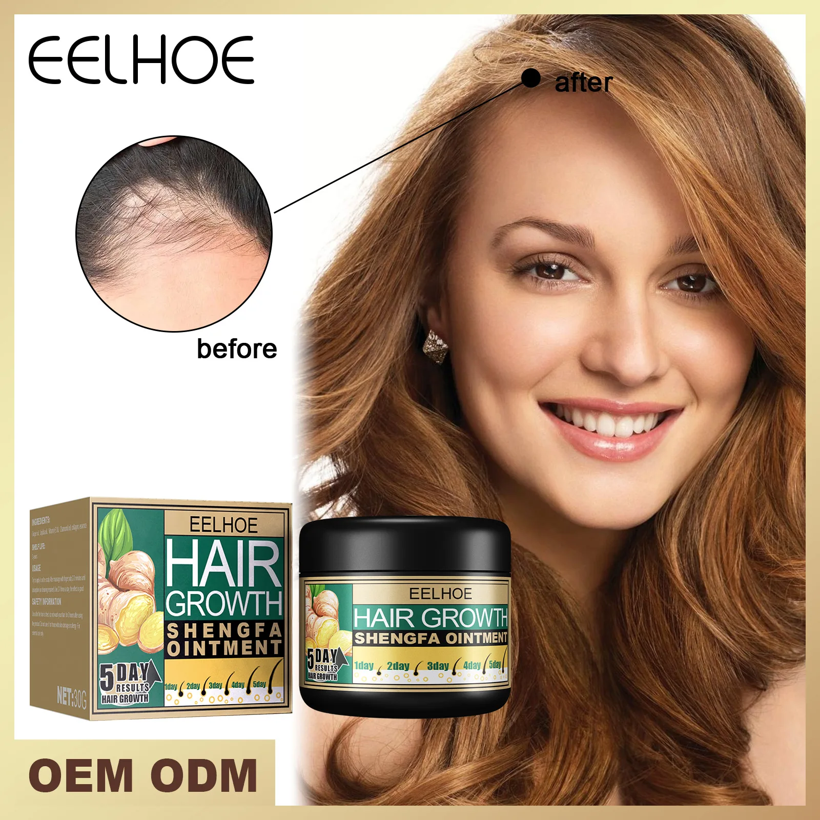Eelhoe 30ml Ginger Hair Loss Treatment Hair Growth Cream Moisturizing