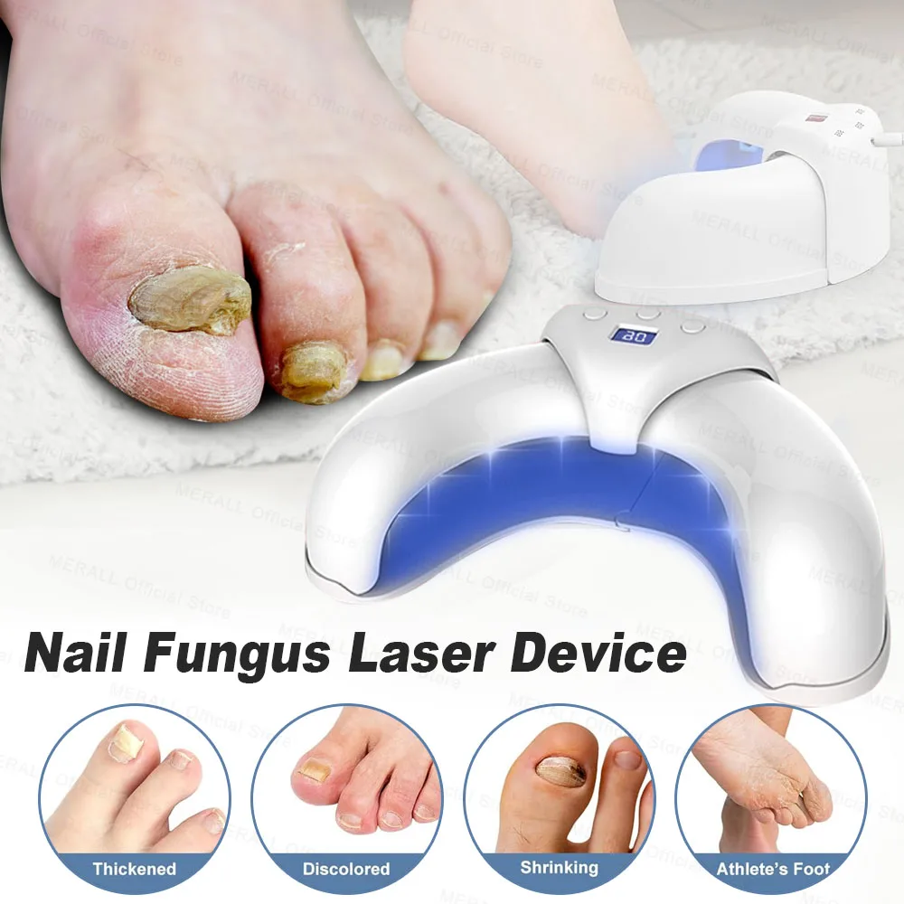 ToenailFungalNailLaserTreatmentRepairFastNailsFungusOnychomycosisRepairFoot