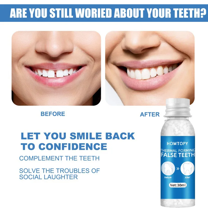Resin Tooth Repair Glue Shapeable Teeth Gaps Filling Solid Glue Temporary Teeth Repair Falseteeth Safety Dental denture adhesive