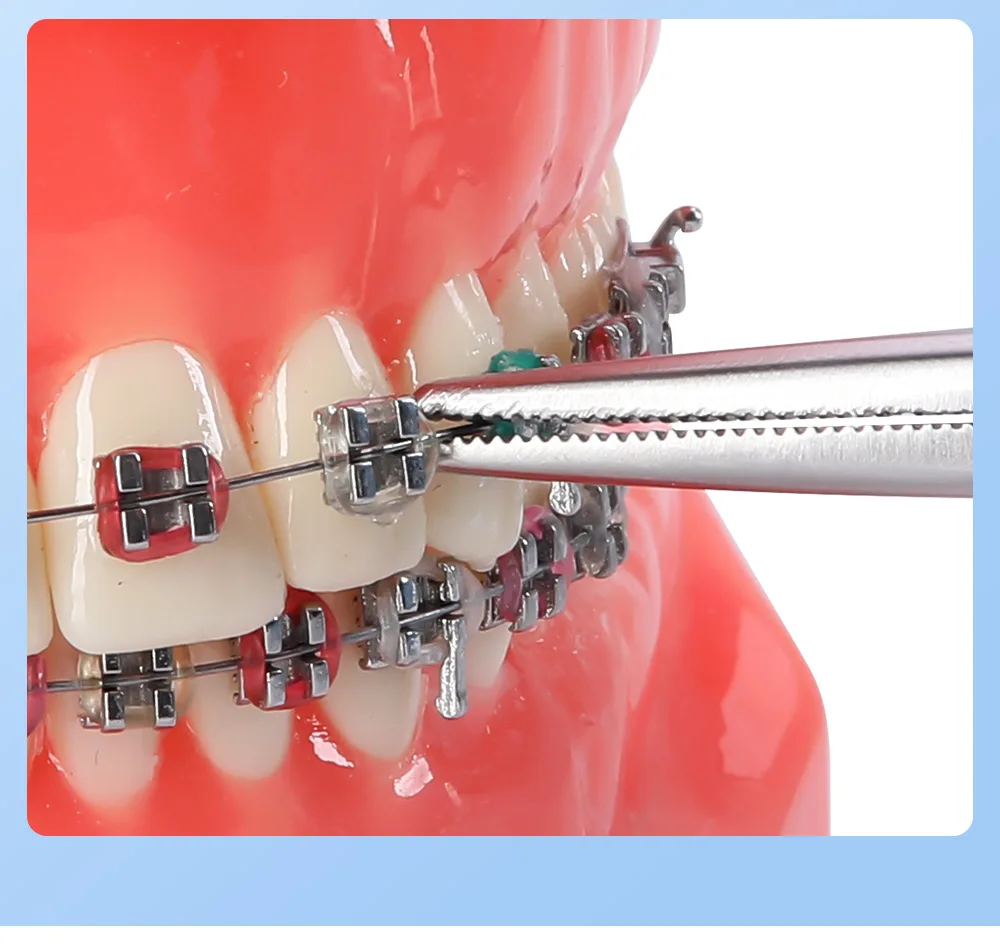 AZDENT Dental Kieferorthopädische Elastische Platzierung Ligatur Krawatte Halter 14 cm Extra Feinen Schnabel Edelstahl Ligation Ring Dental Werkzeuge – Detail 7