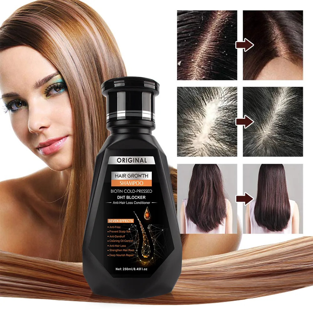 Hair Growth Serum Hair Growth Spray Hair Care Oil Hair Growth Cream Hair Growth Shampoo Set 2pcs/set Hair Growth Essential Oil Biotin Cold-Pressed DHT Blocker and Hair Growth Shampoo Anti-Hair Loss Conditioner