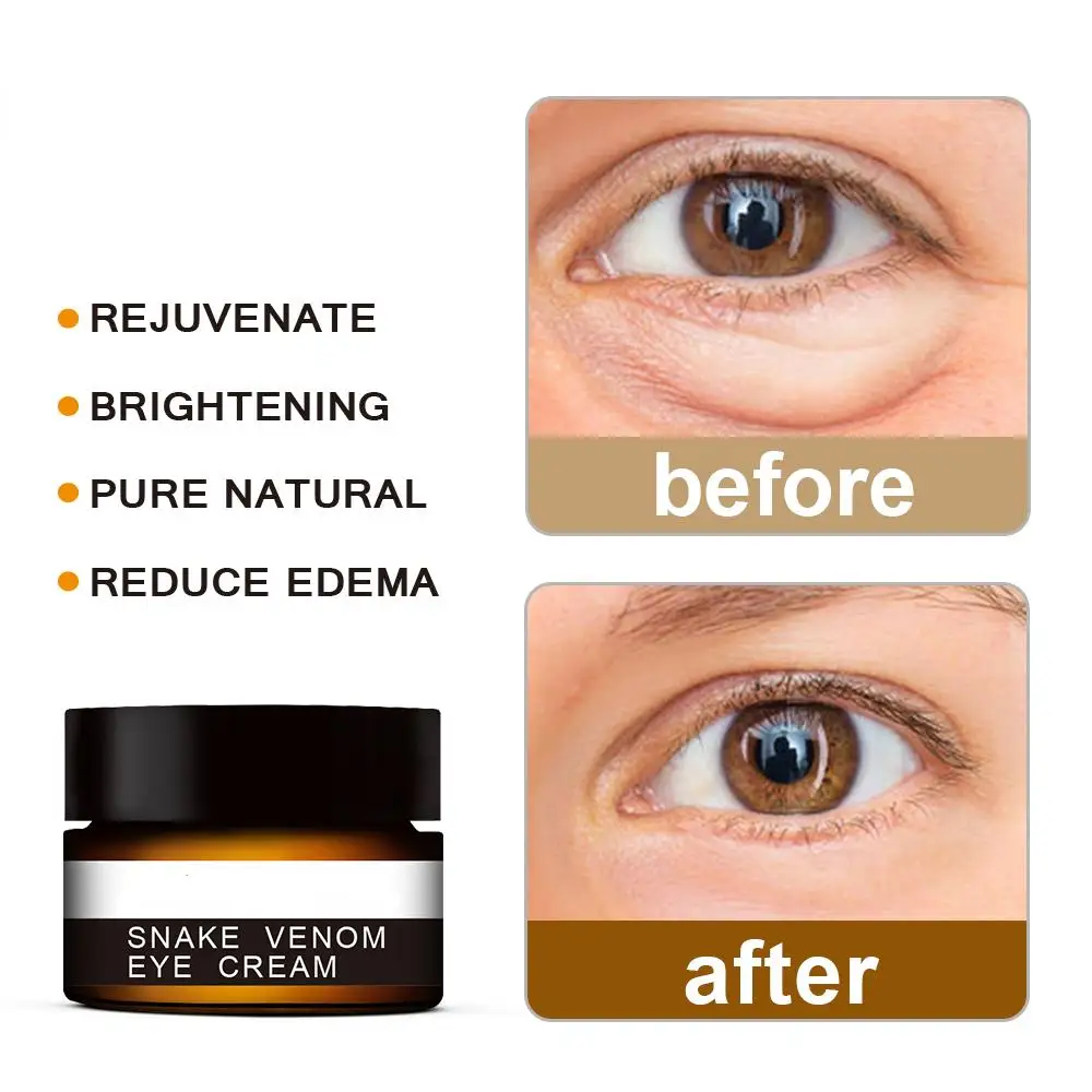 Peptide Anti-Wrinkle Eye Cream Collagen Anti Dark Circle Anti-aging Gel Hyaluronic Acid Anti-Puffiness Eye Bags  Cosmetics