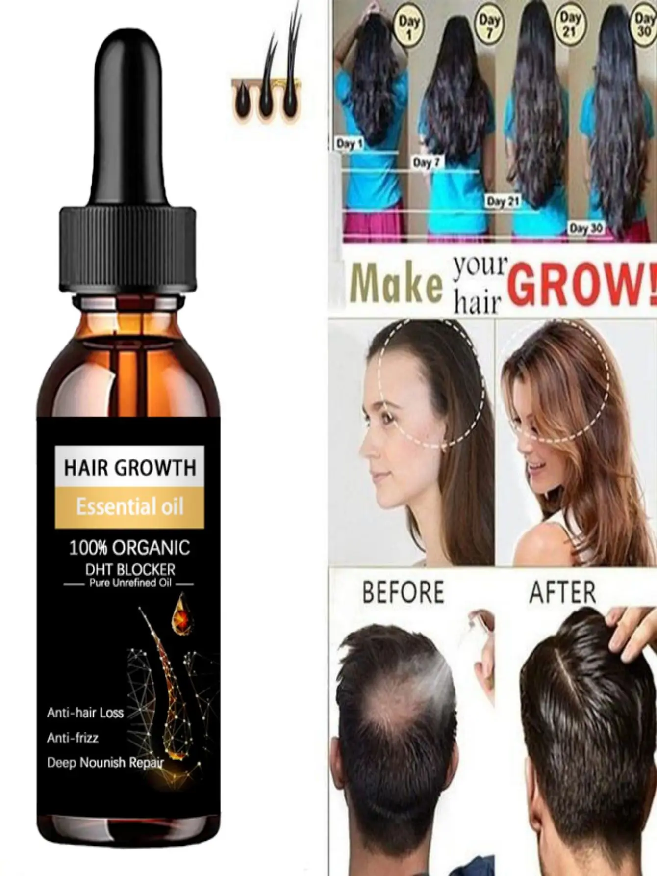 Ginger Hair Growth Oil Hair Essential Oil Serum Anti Lost Beauty Products Fast Grow Repair Scalp Frizzy Damaged Hair Care