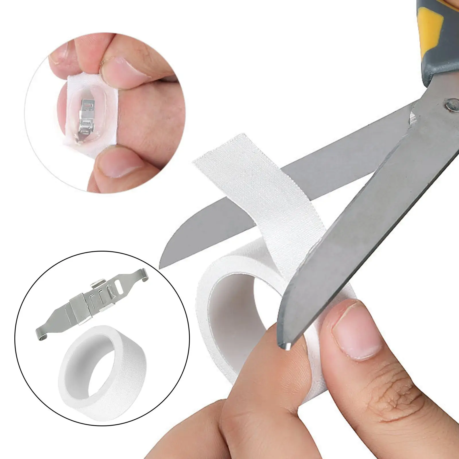 Cat Ingrown Nail Removal