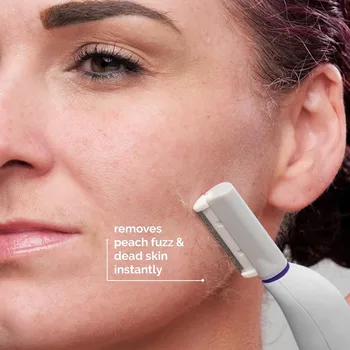 Michael Todd Beauty - Sonicsmooth – SONIC Technology Dermaplaning Tool - 2 in 1 Women’s Facial Exfoliation 2
