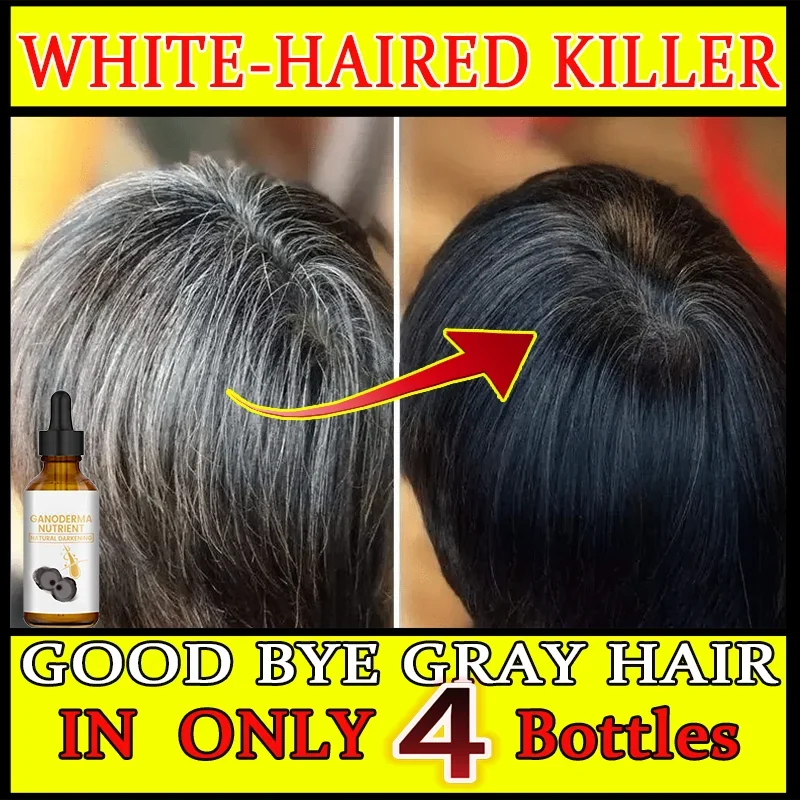 White hair killer, remove gray hair and restore natural color in 7 days Healthy,quickly turns white airh into black