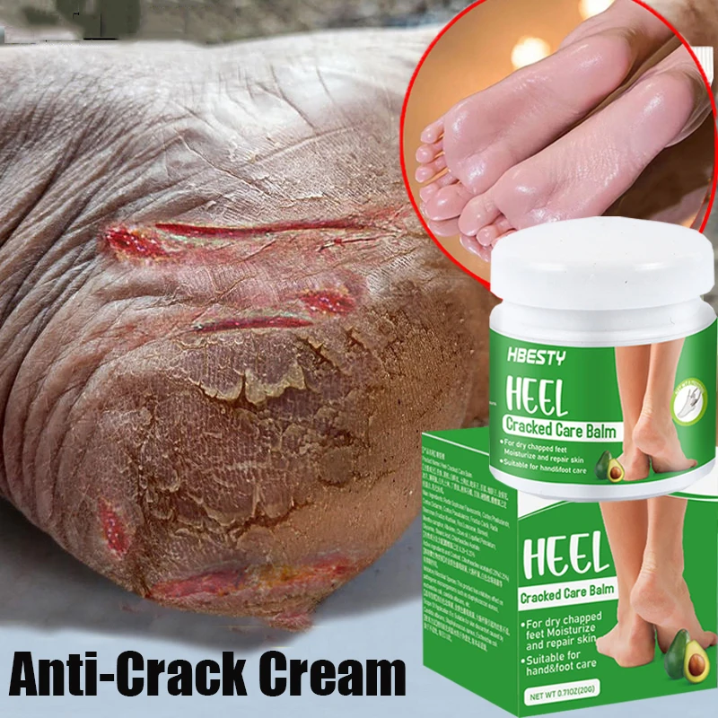 Крем травяной для удаления трещин и зуда на пятках