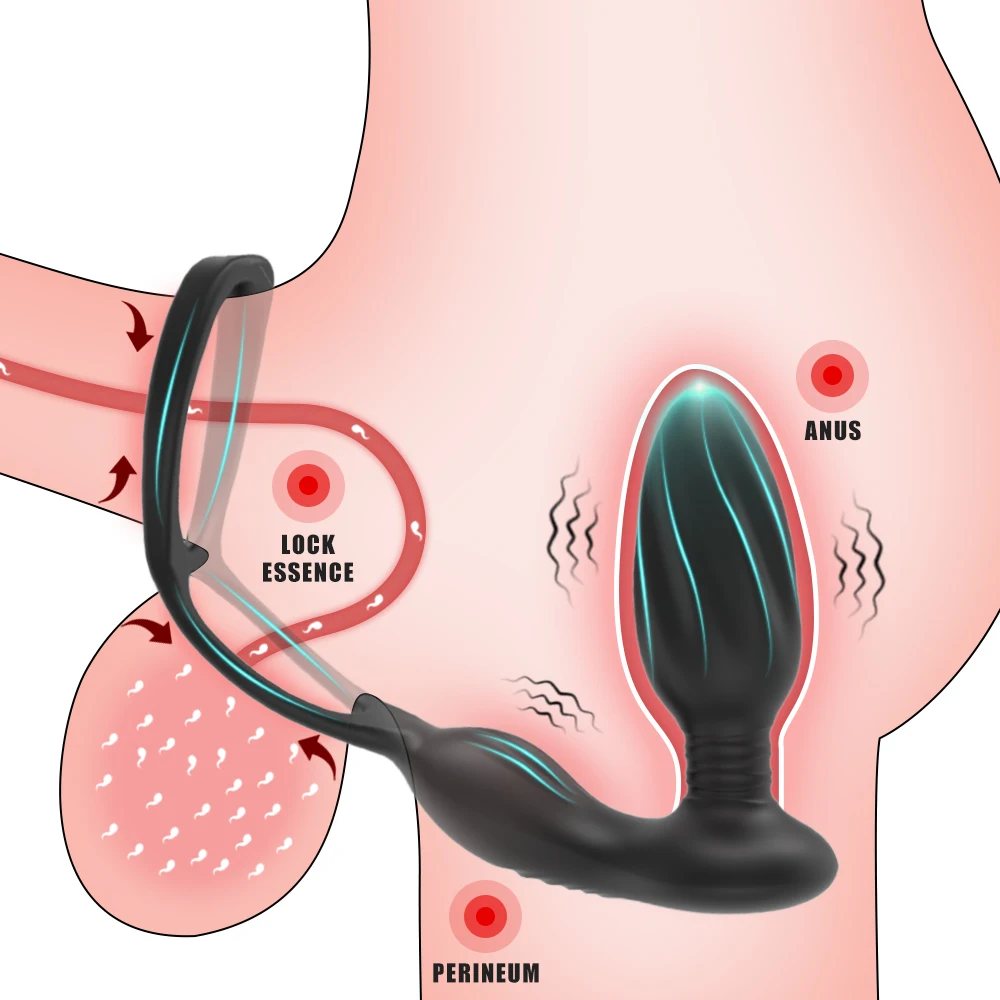 APP Anal Vibrator Sex Spielzeug Für Männer Fernbedienung Butt Plug Anal Plug Männlichen Prostata-massagegerät Vibrierende Erwachsene Sex Spielzeug für Frauen 1
