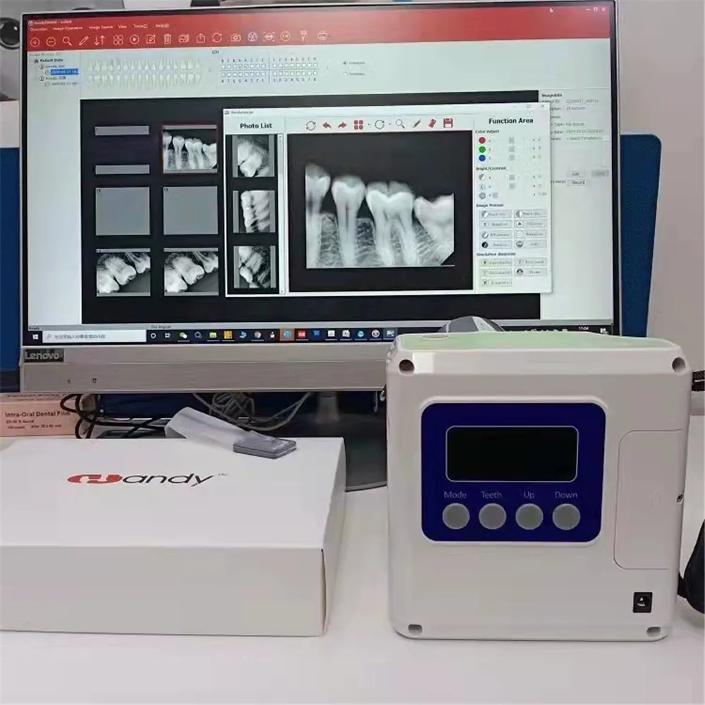 

Hot Sell Dental Digital X Ray Machine Handheld Dental Unit Portable Imaging Unit with HDR500 sensor