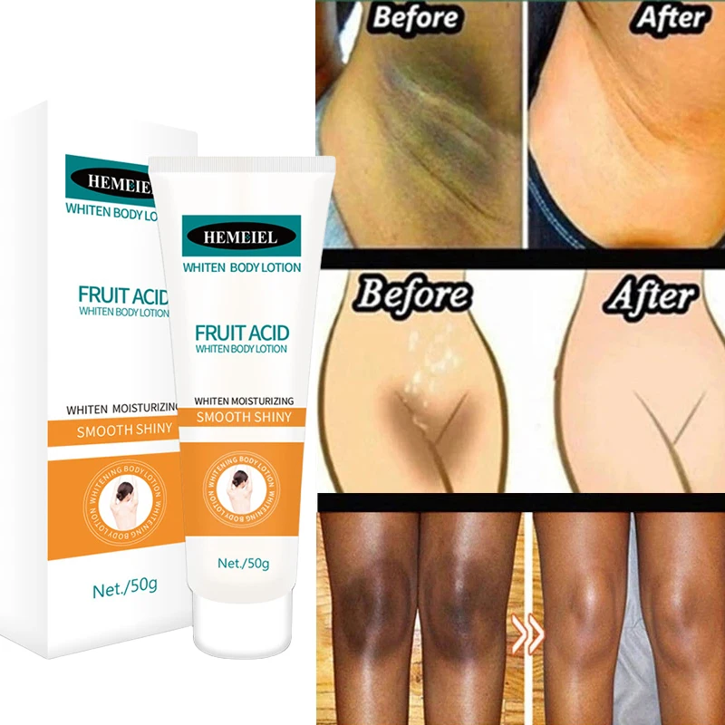 

Body Whitening Cream For Dark Skin Body Lotion Skin Lightening Cream Armpit Lightening Intimate Area For Women Moisturizer 50g