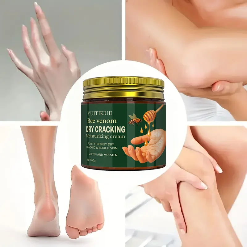 Bee venom dried crack moisturizing cream is suitable for extremely dry, cracked, and rough skin, softening and smoothing it.