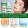 Salicylic Acid Acne Removal Face Serum Pimple Treatment Anti Blackhead Oil Control Shrink Pore Soften Facial Moisturizer Essence 4
