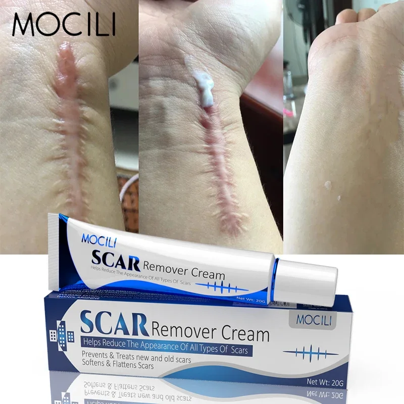 

Herbal Acne Scar Removal Cream Burn Surgical Scars Stretch Marks Repair Cesarean Scar Treatment Gel Whitening Smooth Skin Care