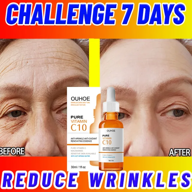 C10-Vitamin Ráncellenes Arc Szérum-Öregedésgátló Fale Fine Lines Flighting Forwing Forming Hidrater Javító Bőrápolási Termékek