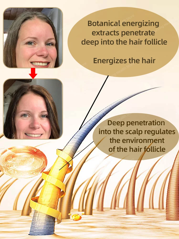 안티 그레이 헤어 세럼 